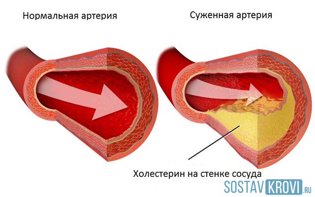 Чем важны здоровые сосуды