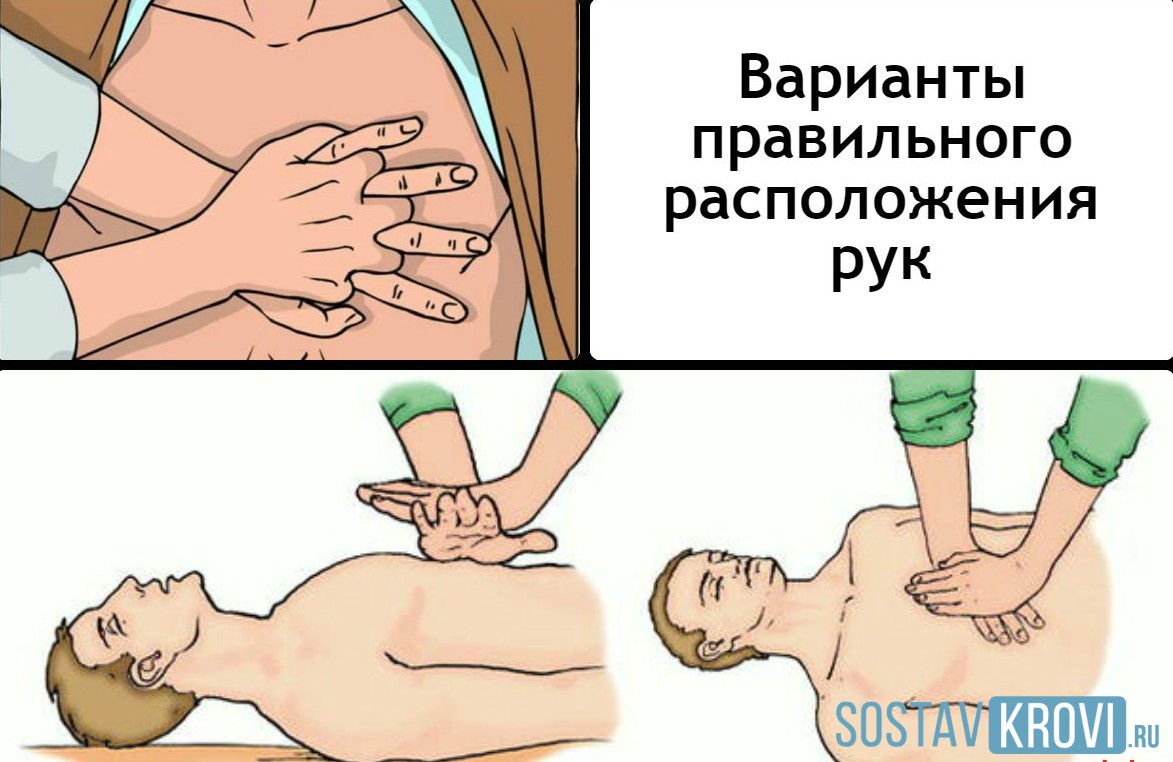 Неотложная помощь