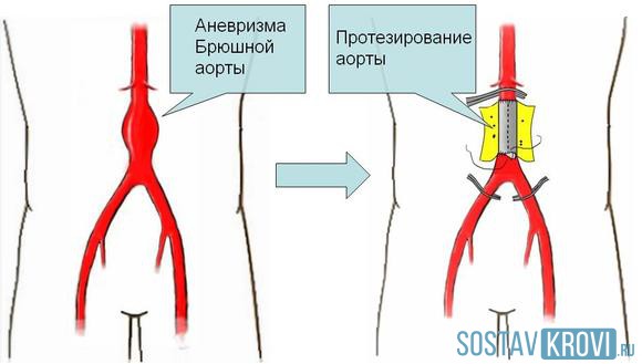 Лечение