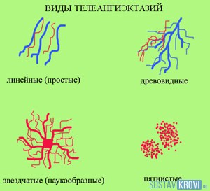 Причины