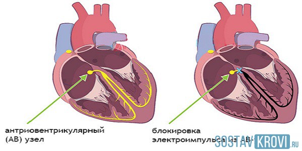 Причины