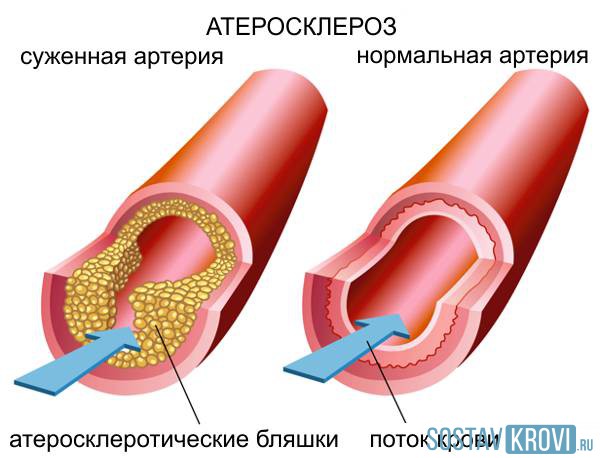 Причины