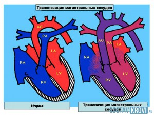 Особенности