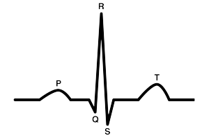 нормальный ЭКГ-комплекс