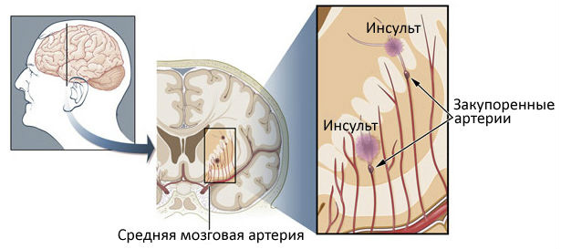 54684846886