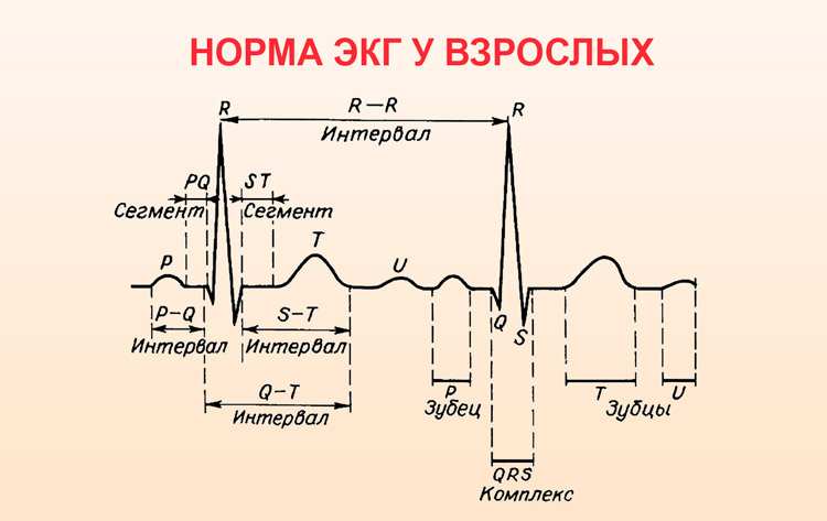 Электрокардиограмма