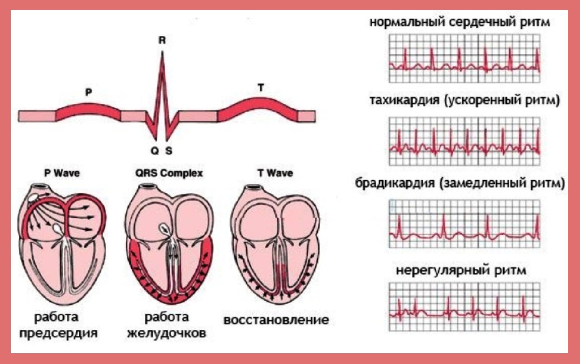 Нарушения сердечного ритма