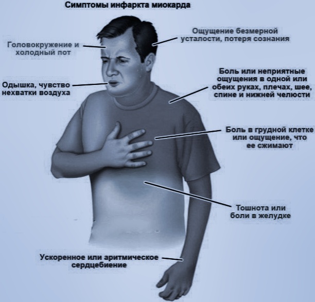 Как происходит инфаркт у человека на лице фото