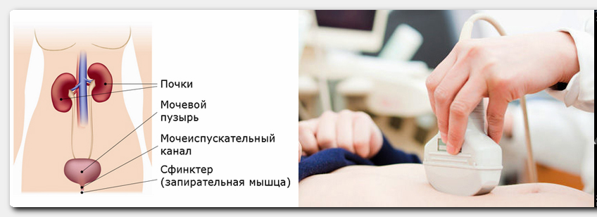 Пройти узи мочевого пузыря. УЗИ уретры и мочевого пузыря. УЗИ почек и мочевого пузыря. УЗИ мочевого пузыря у женщин. УЗИ мочеполовой системы у женщин.