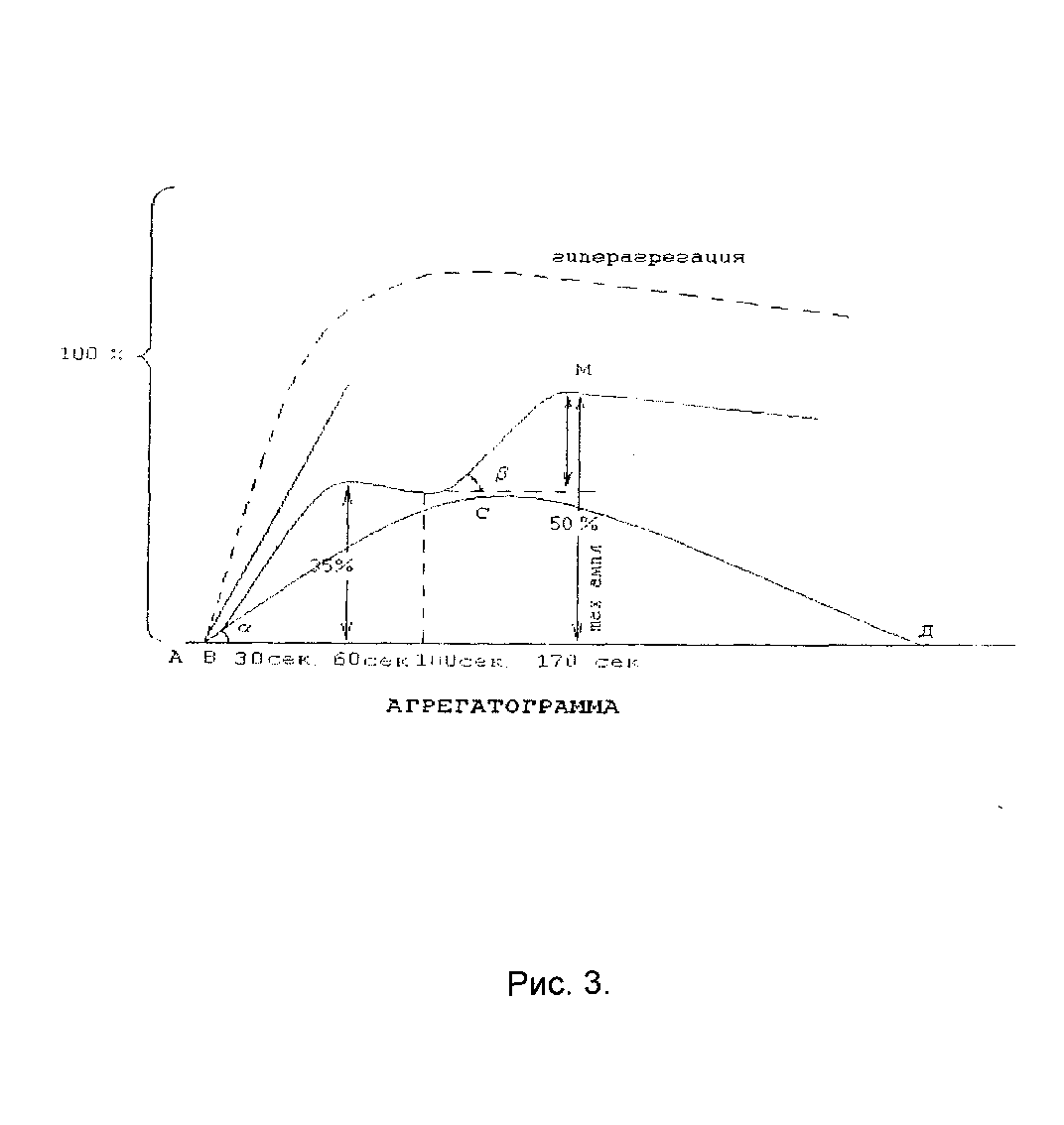 Метод ли. Агрегатограмма. Расшифровка агрегатограммы. Агрегатограмма физиология. Агрегометрия световая.