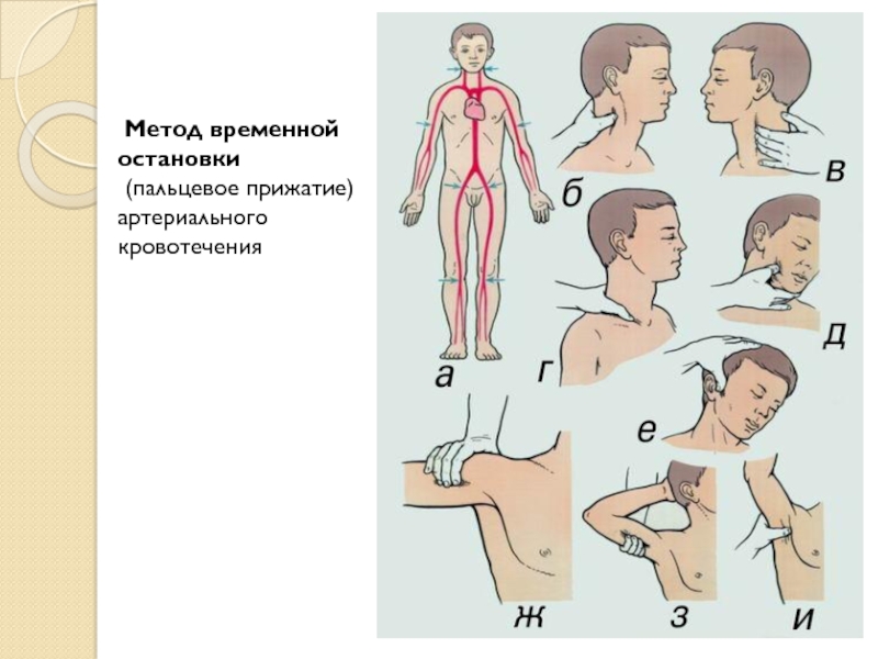 Способы остановки кровотечения головы. Способы временной остановки артериального кровотечения. Временный метод остановки артериального кровотечения. Методы пальцевого прижатия артерий. Методы временной остановки кровотечения пальцевое прижатие.