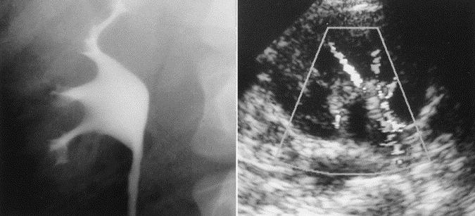 fetal abnormalities