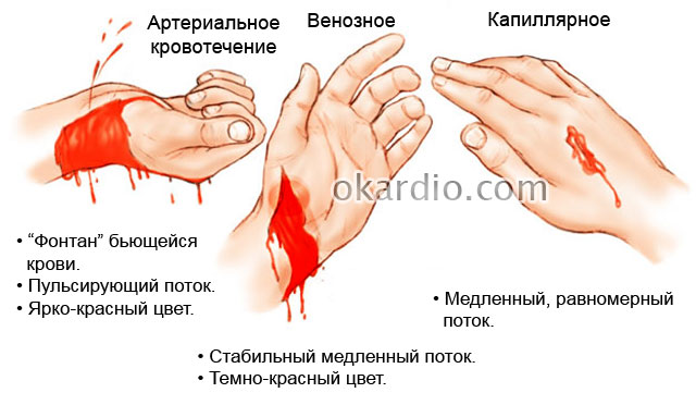 В случаях артериального кровотечения необходимо