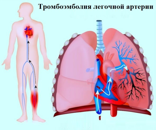 Как применять гель и бальзам Реновен от варикоза