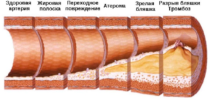 Болезни сосудов нижних конечностей