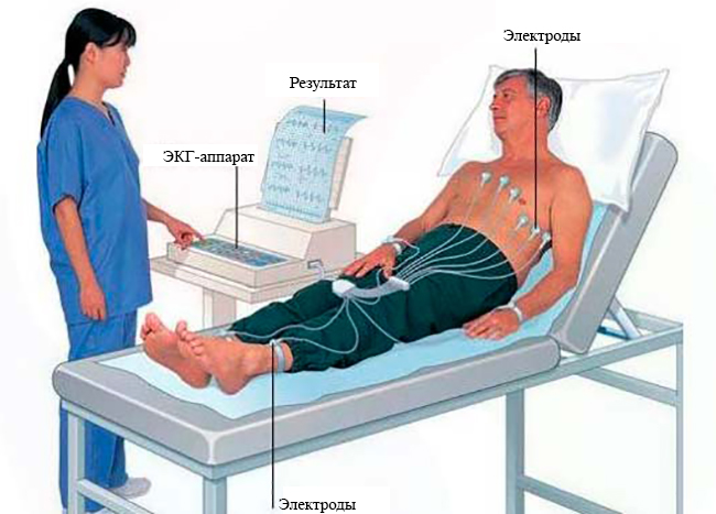 Как проводят ЭКГ