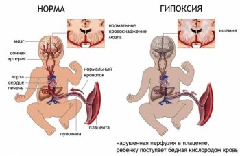 Иллюстрация 6