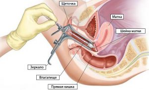 Процедура взятия мазка