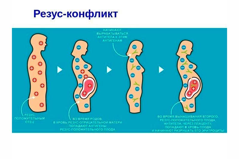 Резус-конфликт