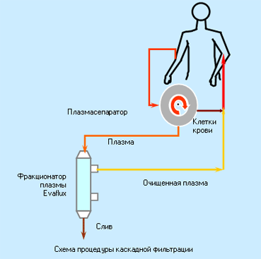 Фильтрующая плазма крови. Центрифужный плазмаферез аппарат. Схема центрифужного плазмафереза. Центрифужный плазмаферез схема. Дискретный (центрифужный) плазмаферез.
