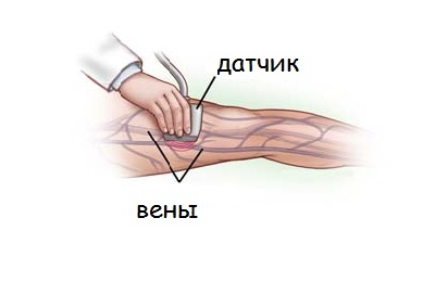 Lуплексное сканирование сосудов конечностей