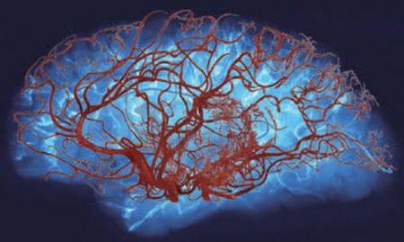 Препараты улучшающие мозговое кровообращение