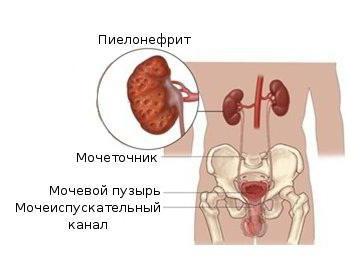 симптомы анурии