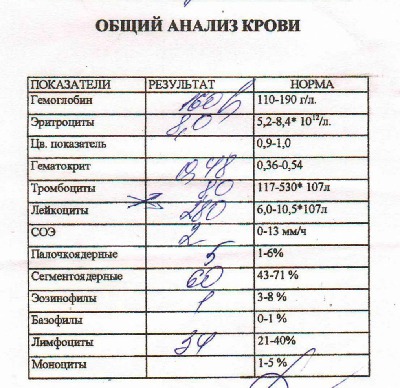 Проходить анализ. Сдать общий анализ крови. Общий анализ крови берут. Анализы на кровь медкомиссия. Какие анализы берут при устройстве на работу.