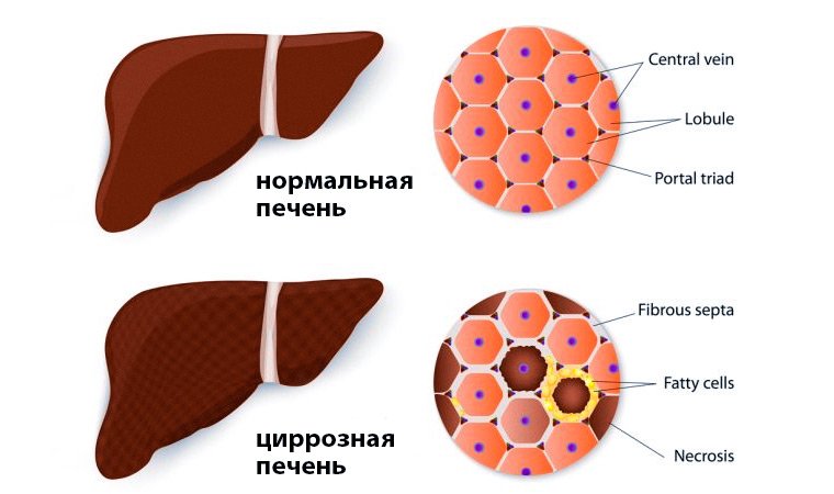 Дополнительные исследования