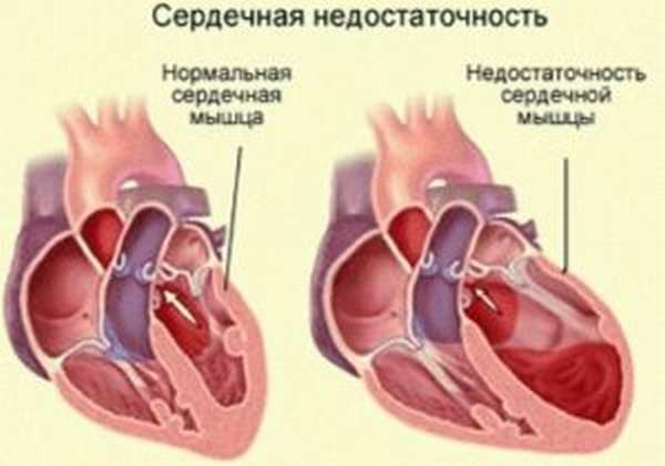 Выпирают вены на руках