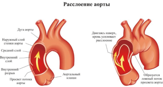 Поясница может болеть от сердца